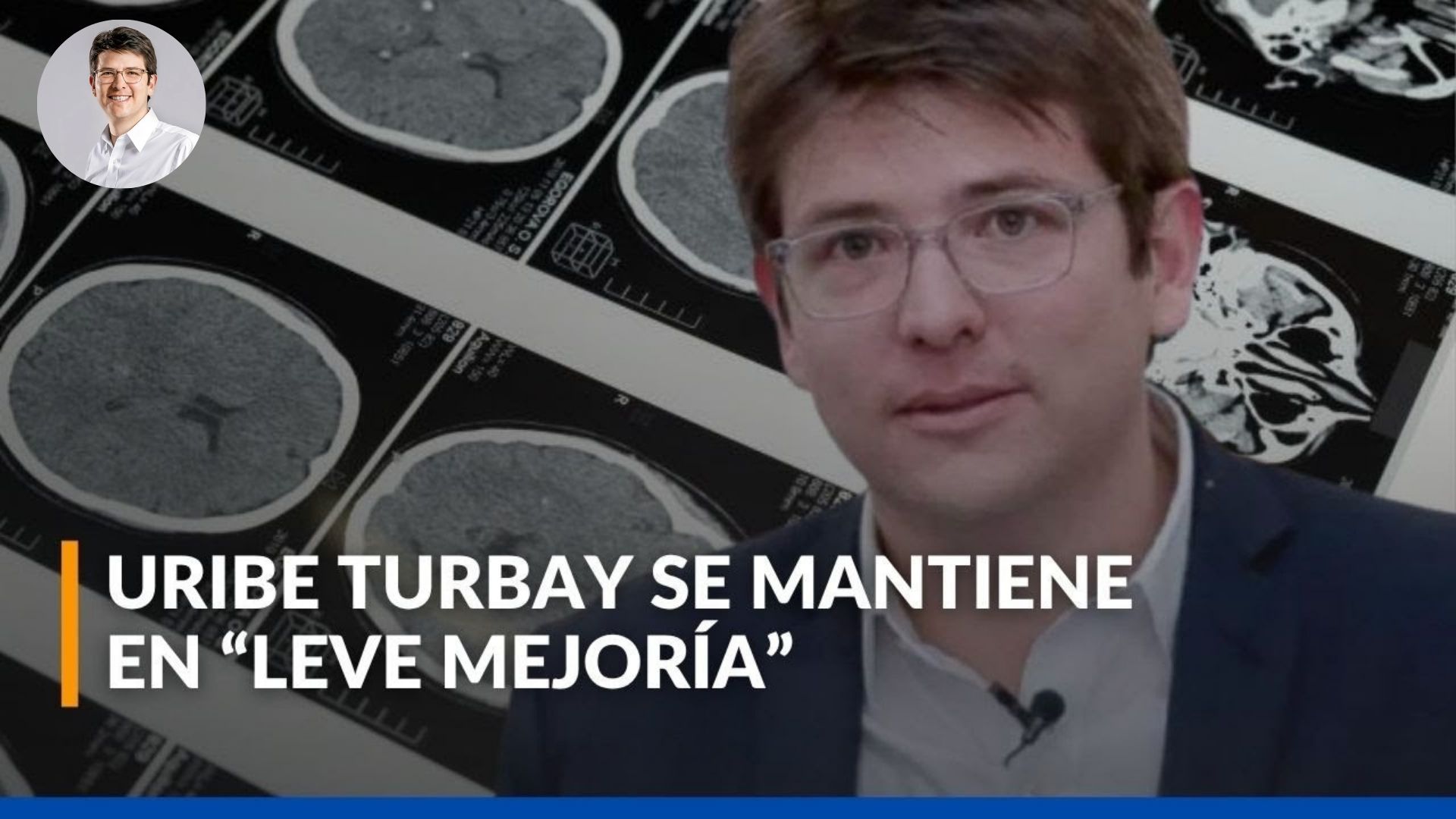 Estado de salud de Miguel Uribe continua con “leve mejoría neurológica”, pero en “condición crítica”
